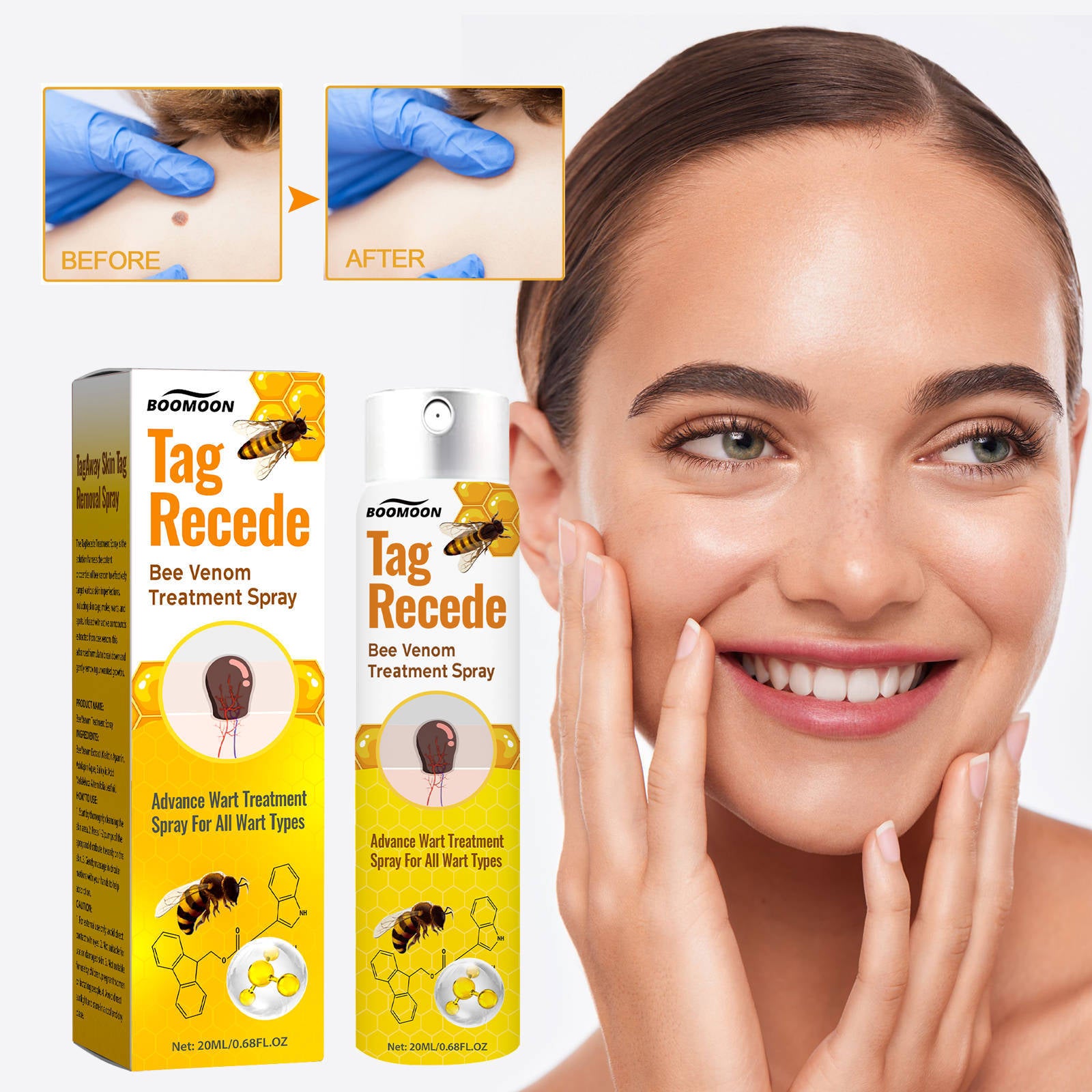 BeeRx Mole Removal Spray completely removes skin tags in just 7 days and promotes natural skin regeneration!